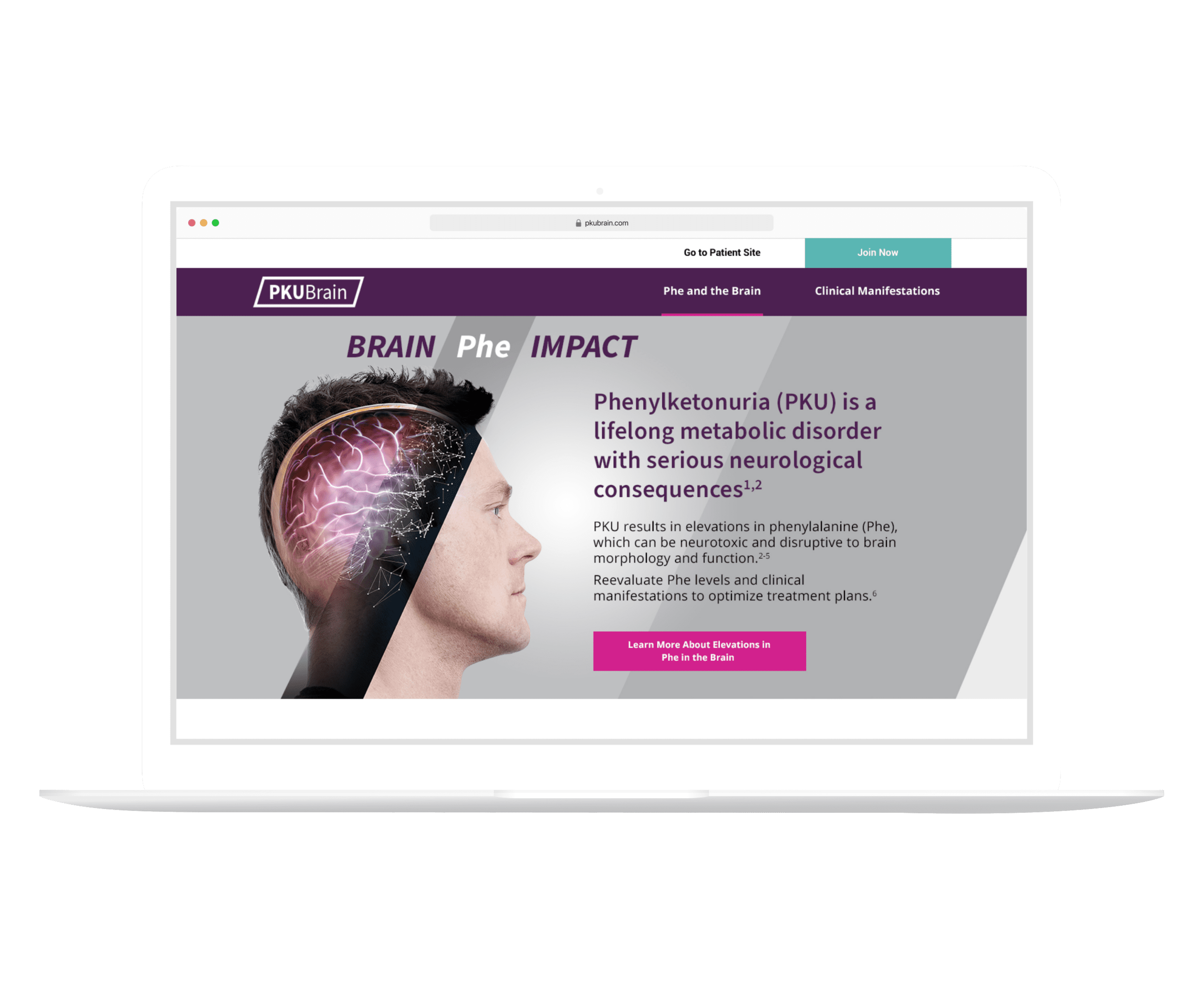 BioMarin PKUBrain HCP Website