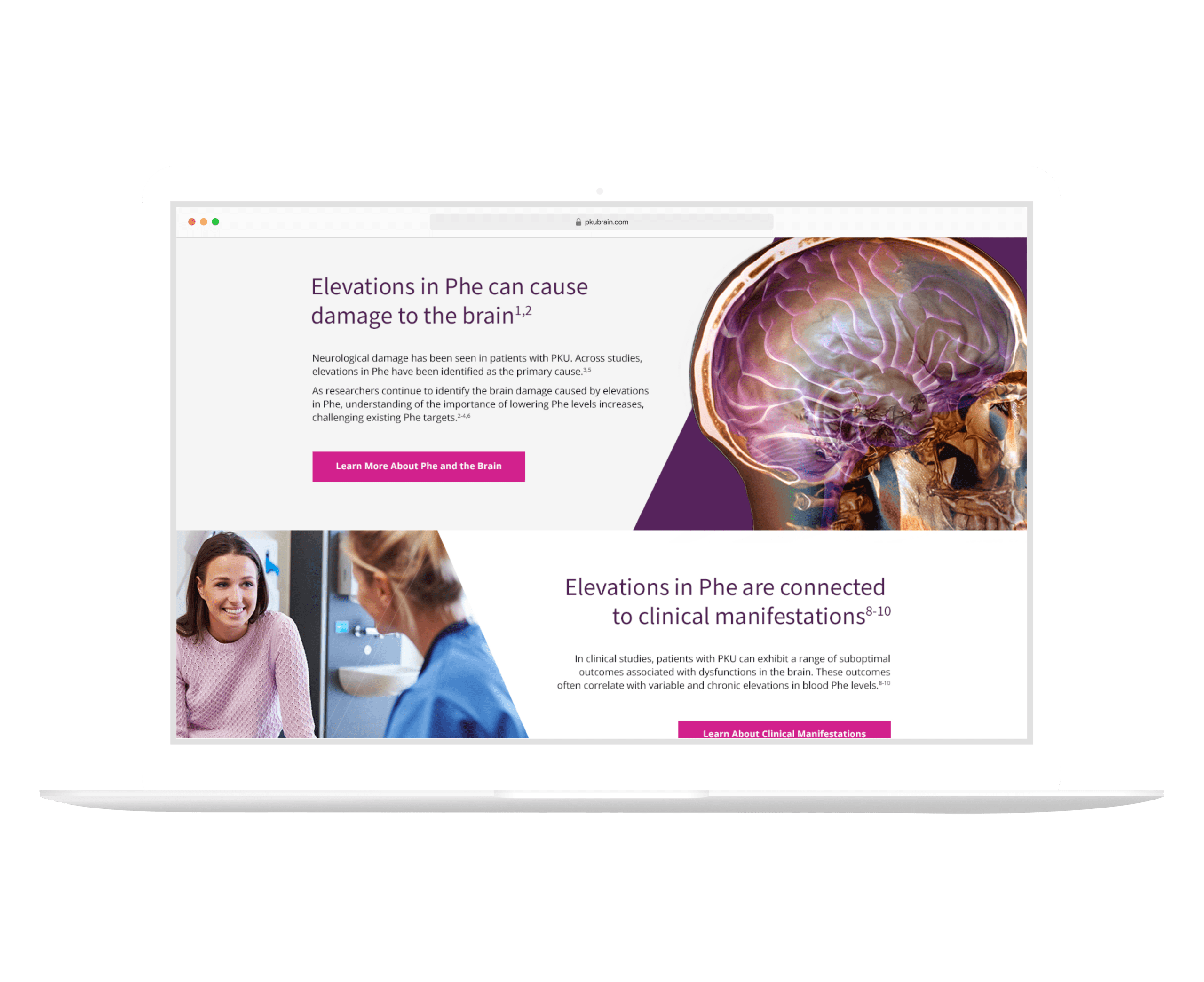 BioMarin PKUBrain HCP Website
